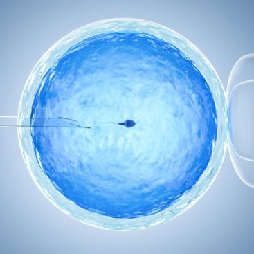 Tüp Bebek Tedavisi Genital Estetik - Doç-Dr-Esra Aktepe Keskin